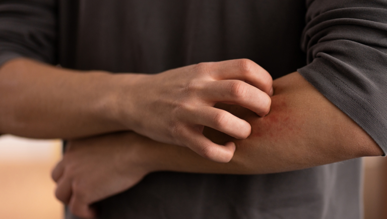 skin rashes and allergies